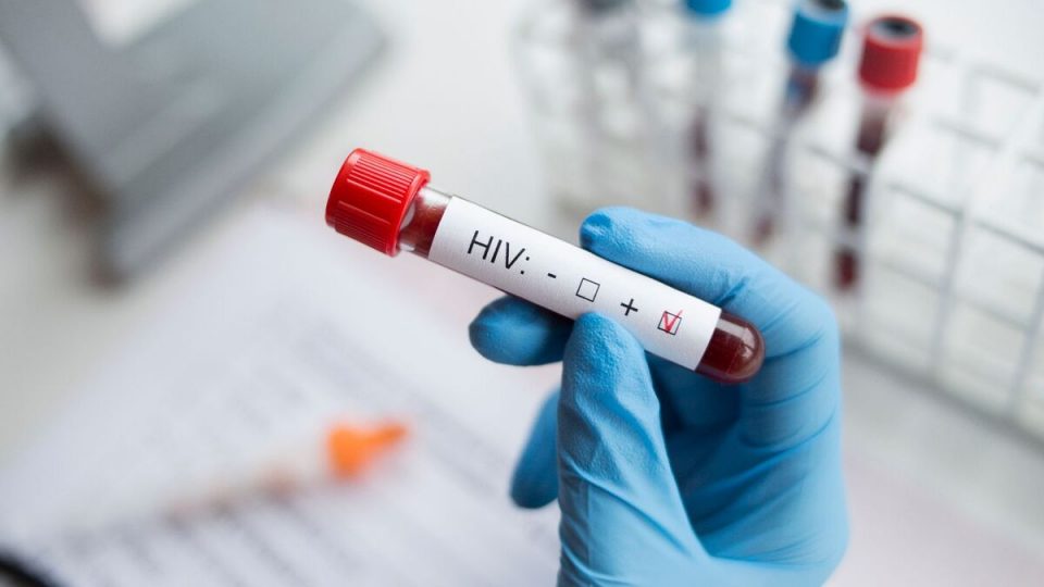HIV: desenvolva repertórios socioculturais para o vestibular